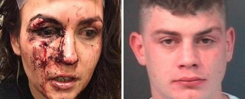 Mulher fica ferida após impedir que jovem agredisse a namorada