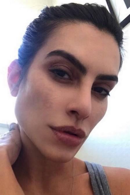 Cléo Pires posa sem make em rede social e fala sobre doença de pele