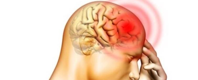 Ceará fica em estado alerta para possível surto de meningite