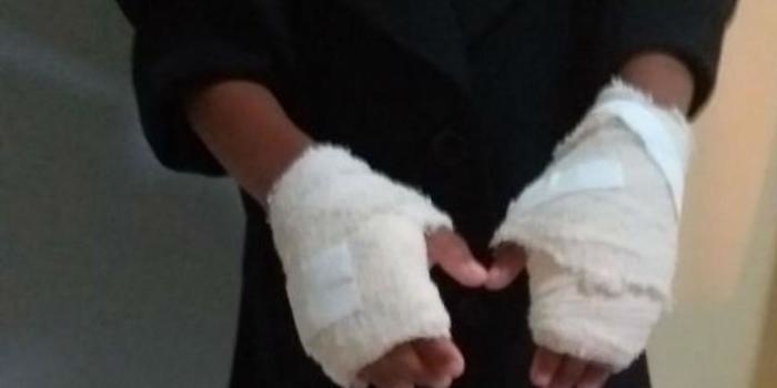 Mulher é presa por queimar mãos de criança com uma colher quente