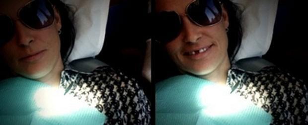 Demi Moore revela que perdeu dois dentes por causa de estresse