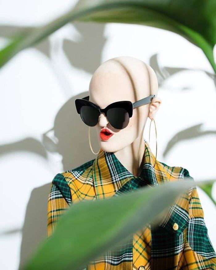 Modelo com síndrome rara faz sucesso no mundo da moda