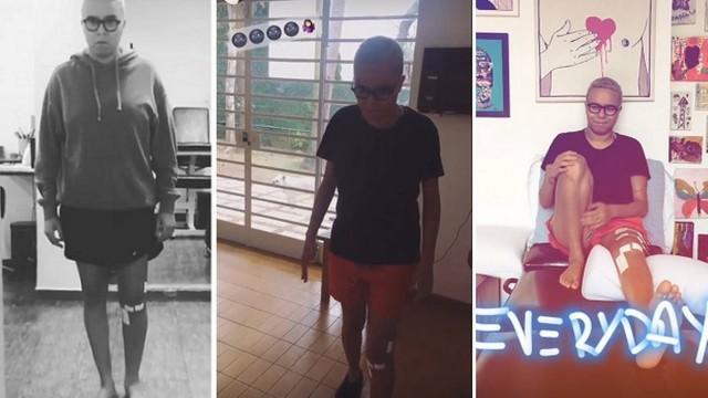 Maria Gadu passa por cirurgia no joelho e tem dificuldade ao andar