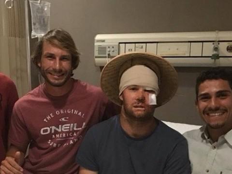 Surfista brasileiro relata salvamento de australiano na Indonésia