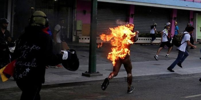 Morre jovem que foi queimado em protesto na Venezuela