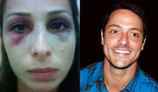 Christiano Rangel agrediu ex-namorada