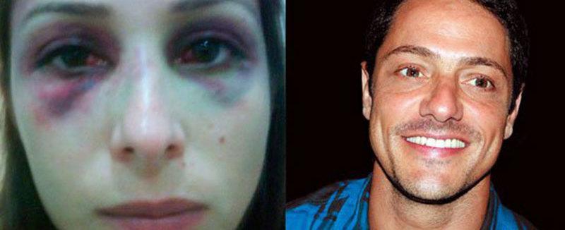 Ex de Luana Piovani é condenado a prisão domiciliar por agressão
