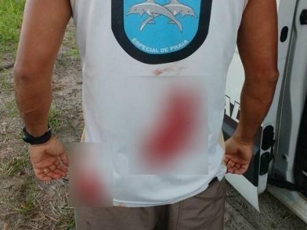 Guarda é esfaqueado ao pedir para homem tirar cachorro de praia