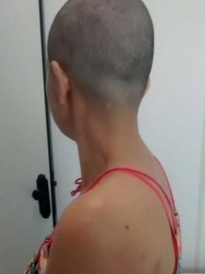 Marido agride esposa após ela sair de casa para cuidar do pai
