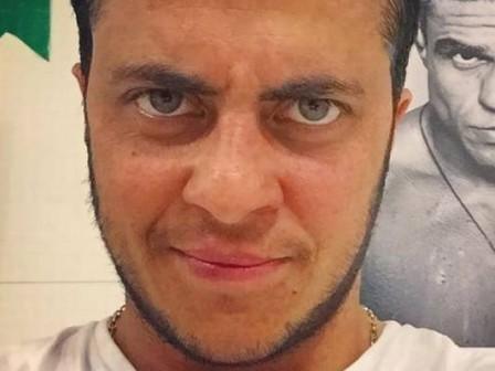"Não pretendo fazer nada para reverter a calvície", diz Thammy