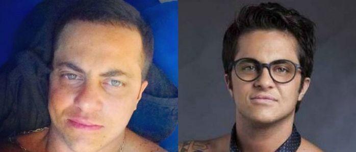Thammy perde cabelo com tratamento hormonal: 'Não me incomoda'