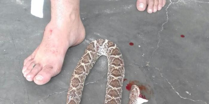 Vereador mata cascavel com os dentes após ser picado