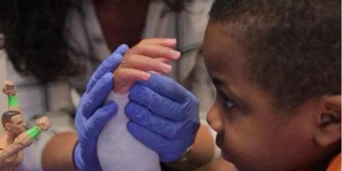 Após 2 anos, criança reage a transplante de mãos com sucesso