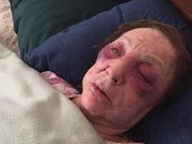 Idosa é agredida e roubada um dia antes de ir ao funeral do marido