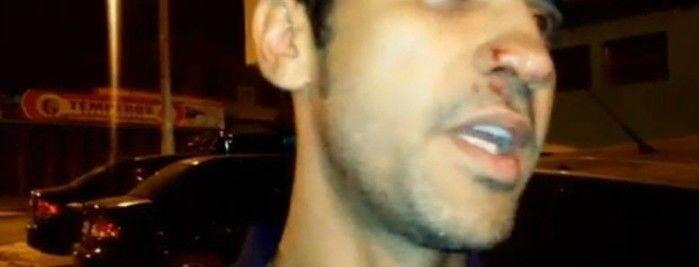 Guarda municipal agredido por menor no Parque da Cidadania (Crédito: Rede Meio Norte)