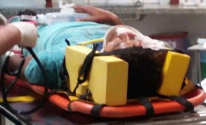 Homem tem o rosto desfigurado após colidir moto em muro
