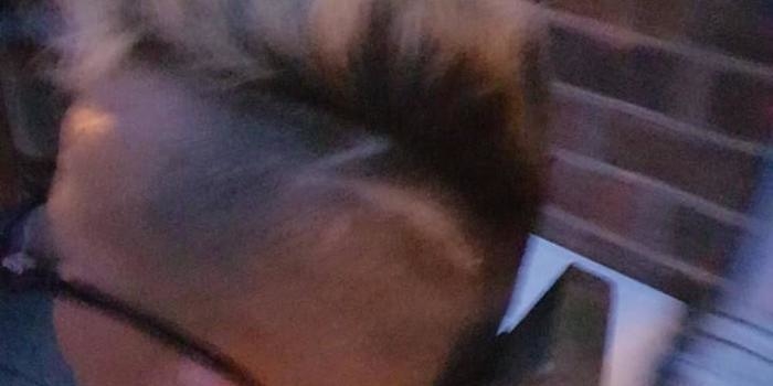 Garoto autista tem pedaço de madeira pregado à cabeça em agressão