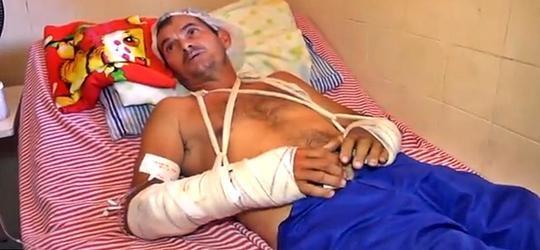 Homem tem os braços quebrados durante assalto em Parnaíba