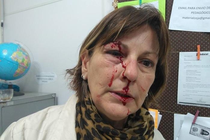 Professora é agredida por aluno de 15 anos após expulsá-lo da sala (Crédito: Reprodução/facebook)