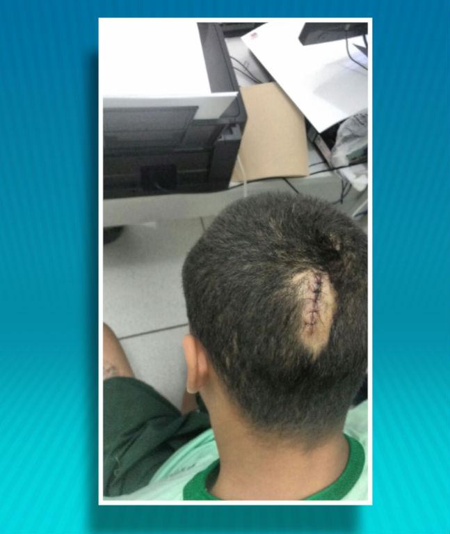 Adolescentes foram agredidos (Crédito: Reprodução)