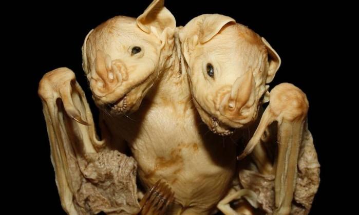 Os gêmeos siameses têm duas cabeças, mas apenas um corpo (Crédito: Reprodução)