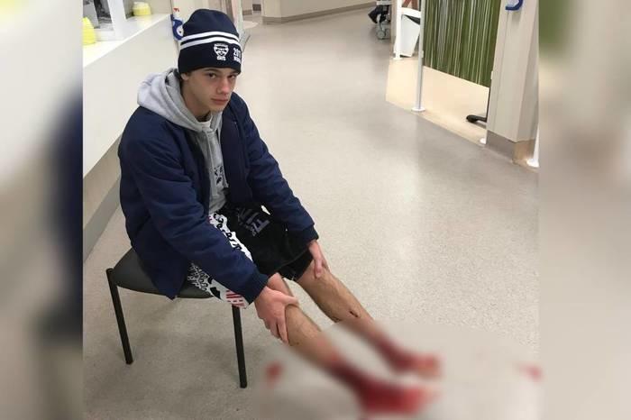 o adolescente com os pés feridos à espera de atendimento médico no hospital (Crédito: Reprodução)