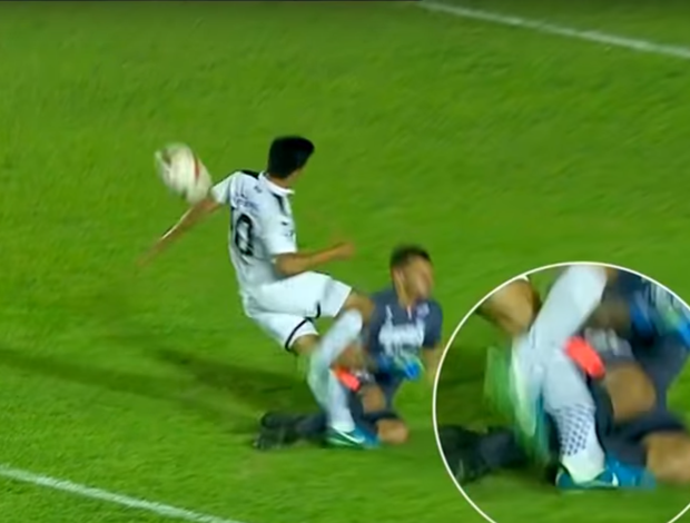 Jogador fraturou a perna (Crédito: Reprodução)