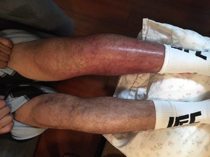 Resultado de chutes durante luta no UFC (Crédito: Reprodução)
