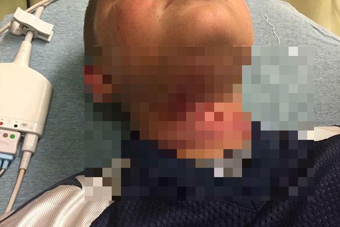 Garoto de 8 anos é enforcado por adolescente em ataque racista (Crédito: Reprodução)