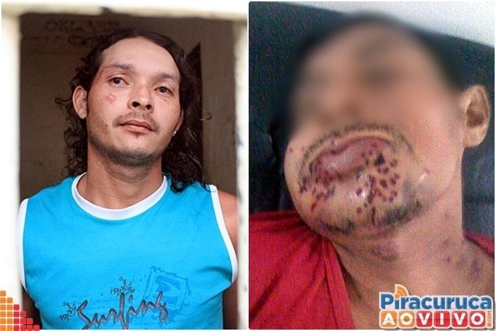 Homem é preso após tenta matar o próprio tio em Piracuruca (Crédito: Reprodução/PM)