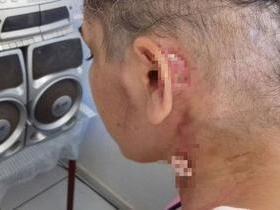 Com bactéria desconhecida, dona de casa pede ajuda para tratamento