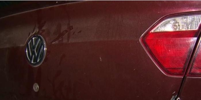 Menino baleado na cabeça em arrastão teve 5 paradas cardíacas