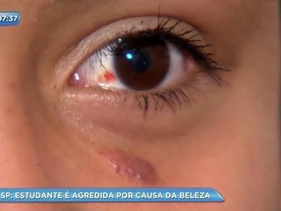 Menina de 13 anos é agredida dentro de escola por “ser bonita”