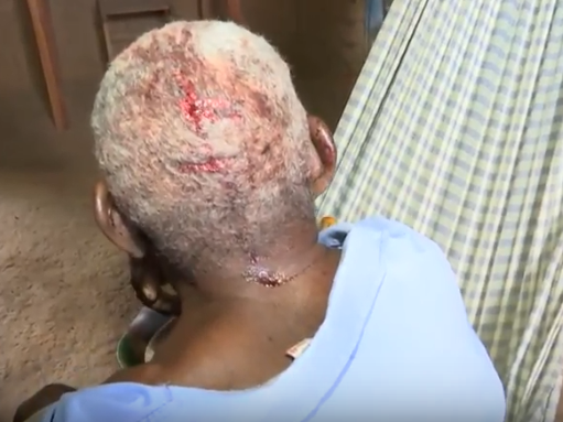 Aposentado é brutalmente espancado por ladrões na zona rural do MA