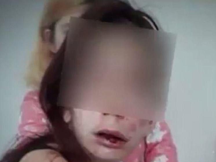 Jovem deficiente é agredida e tem mãos queimadas por adolescentes