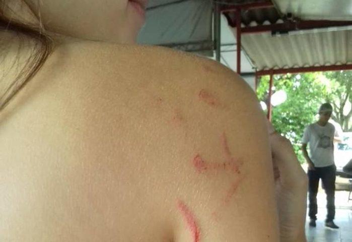 Casal agride adolescente após discussão em fila de mercado