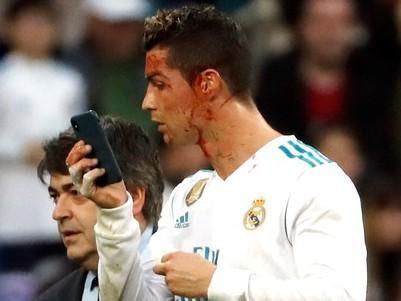 Real goleia o La Coruña por 7 a 1 e volta a vencer no Espanhol