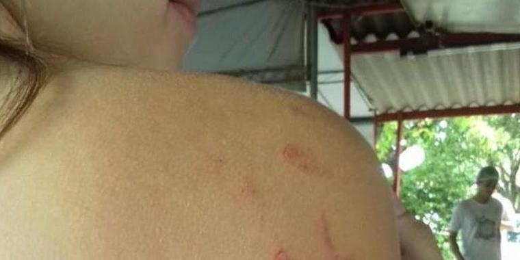 Casal agride adolescente após discussão em fila de mercado