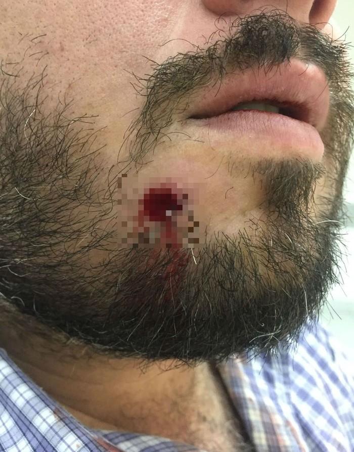 Turista foi baleado no rosto e sobreviveu após bala ficar alojada na boca em Guarujá, SP (Crédito: Arquivo Pessoal)