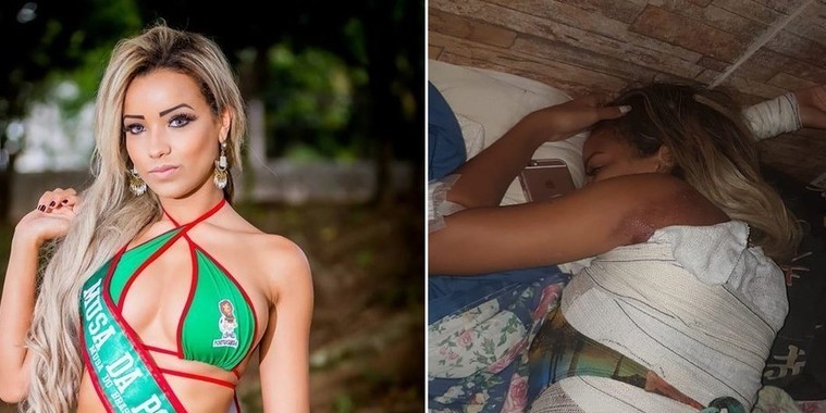 ‘Não sentia o meu corpo’, diz modelo arremessada de van em acidente