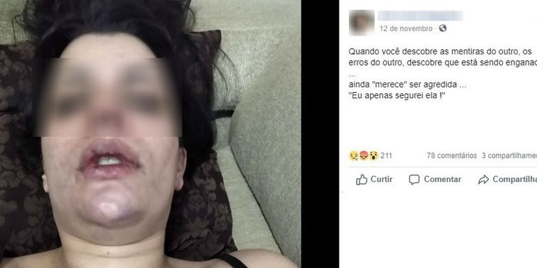 Jovem posta foto para denunciar agressão do namorado em SP
