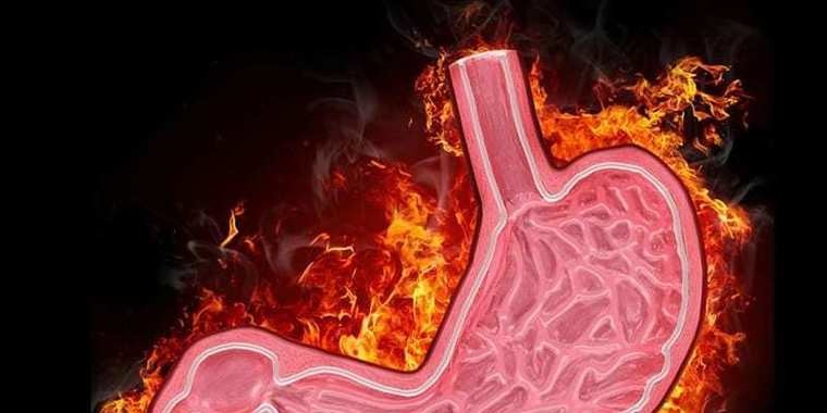 Conheça os tipos de gastrite e seus sintomas no nosso corpo