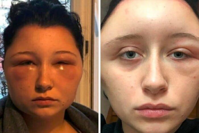 As imagens são chocantes (Crédito: Reprodução/Arquivo Pessoal)
