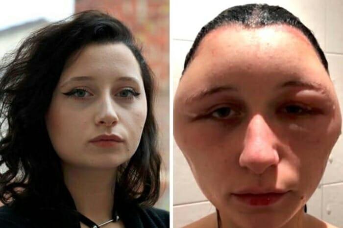 As imagens são chocantes (Crédito: Reprodução/Arquivo Pessoal)