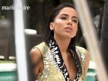 Anitta revela correção no nariz após plástica: 'Ficaram malfeitas'