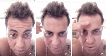 Thammy Miranda reclama que está ficando careca (Crédito: Reprodução)
