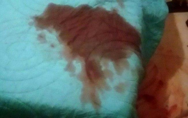 Homem teve o pÃªnis cortado (CrÃ©dito: ReproduÃ§Ã£o)