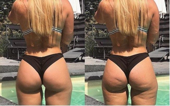 Blogueira choca ao exibir suas celulites