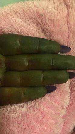 Resultado de imagem para Mulher fica com cor do Shrek após bronzeamento artificial