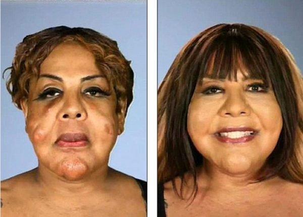 Antes e depois (Crédito: Pinterest Twitter Extra TV M Dig)